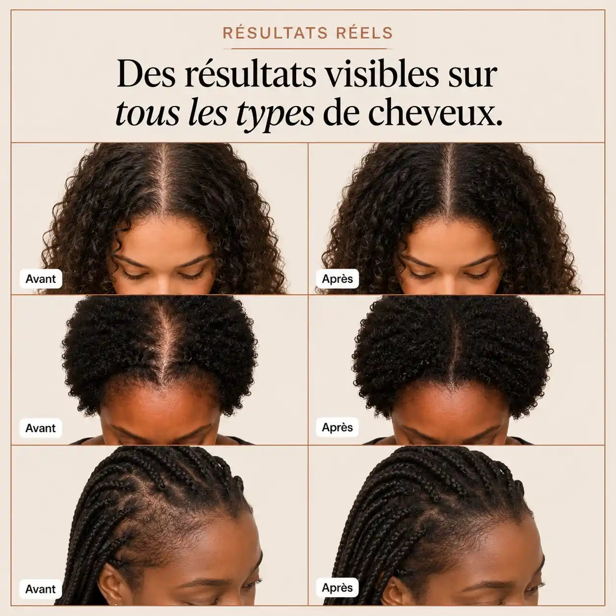 Sérum Pousse Capillaire  Kavira
