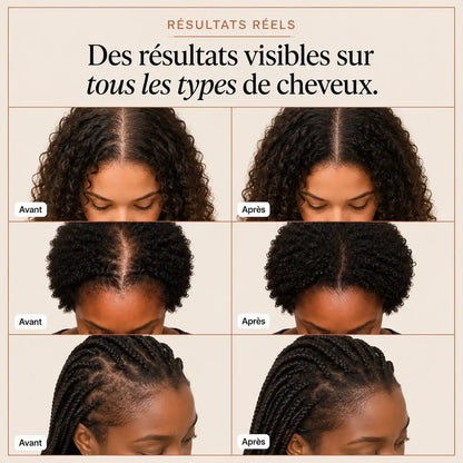 Sérum Pousse Capillaire  Kavira
