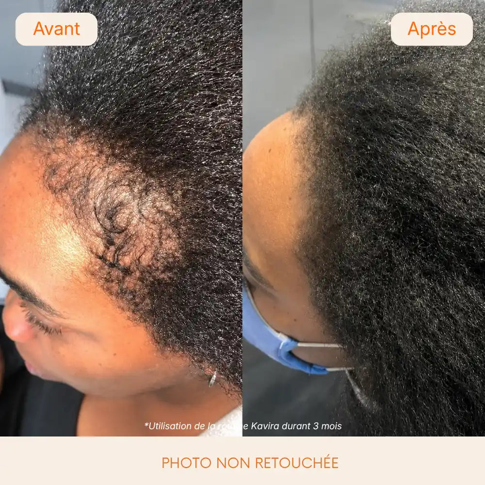 Sérum Pousse Capillaire  Kavira