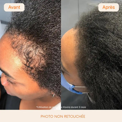 Sérum Pousse Capillaire  Kavira