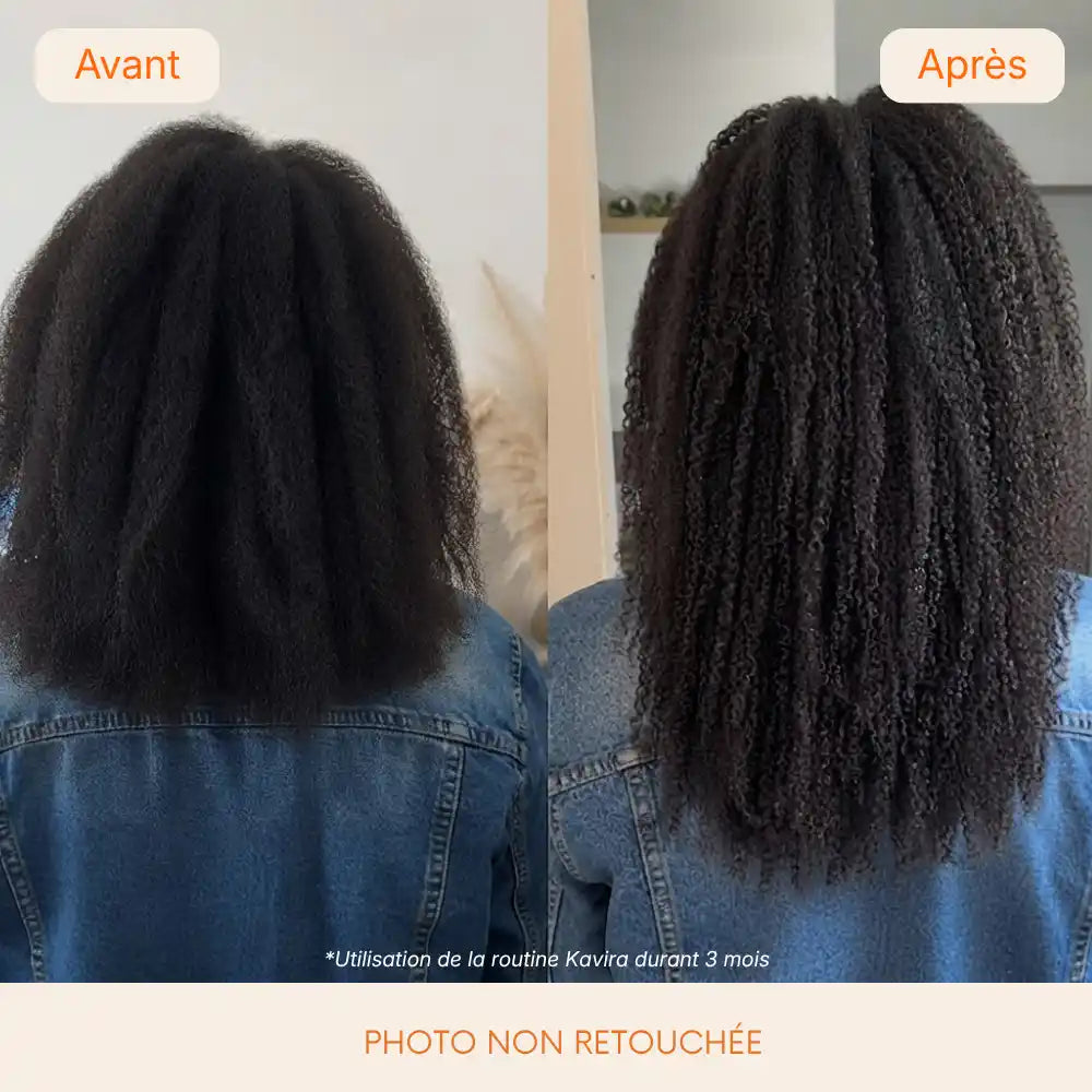 Sérum Pousse Capillaire  Kavira